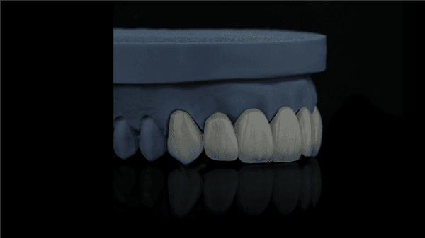 Swiss Implant System