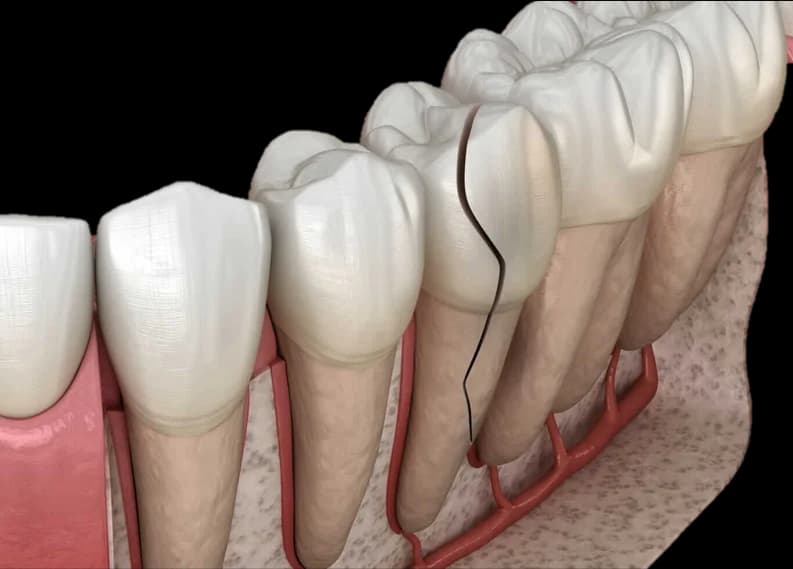 Pediatric Emergency Dental Care