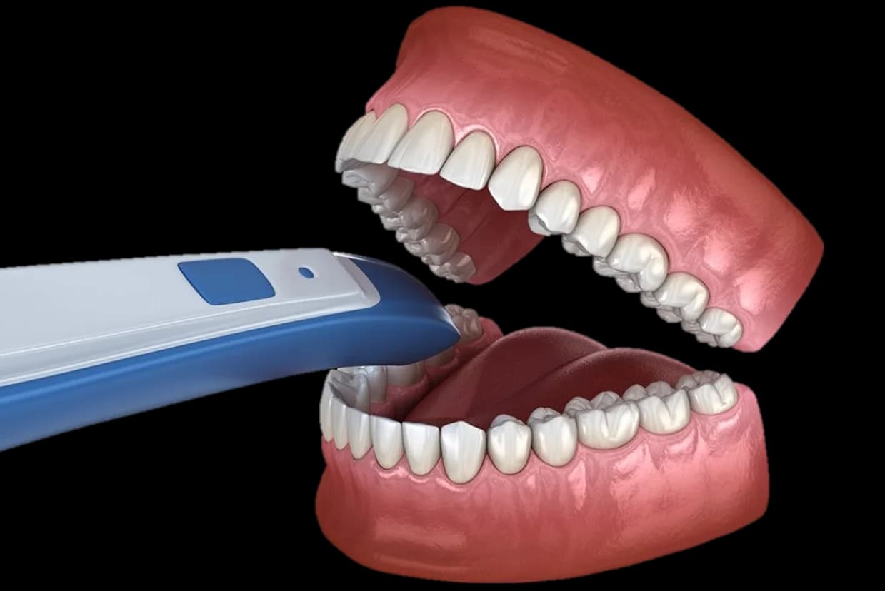 Intraoral Scans