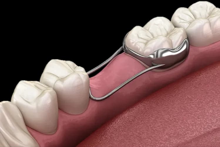 Pre-Orthodontic Guidance