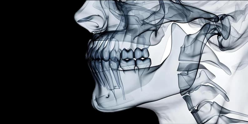 TMJ Disorder Treatment
