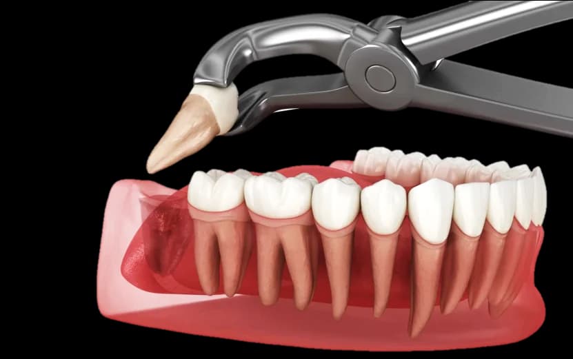 Physics Forceps Technology
